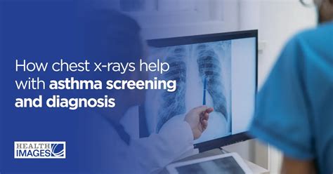 x ray for asthma|Can you detect asthma on an X.